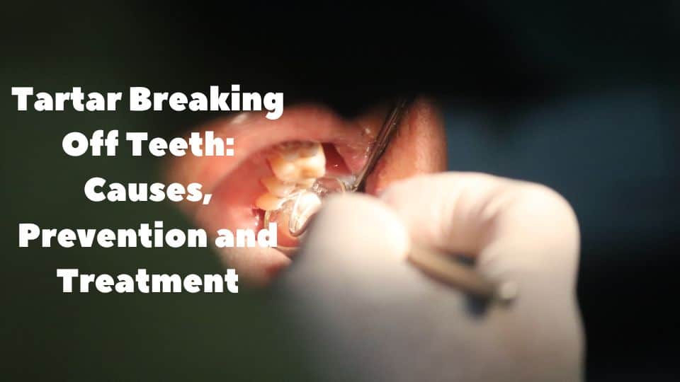 tartar breaking off teeth